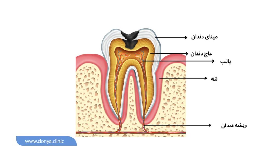 معرفی اجزا محتلف دندان 