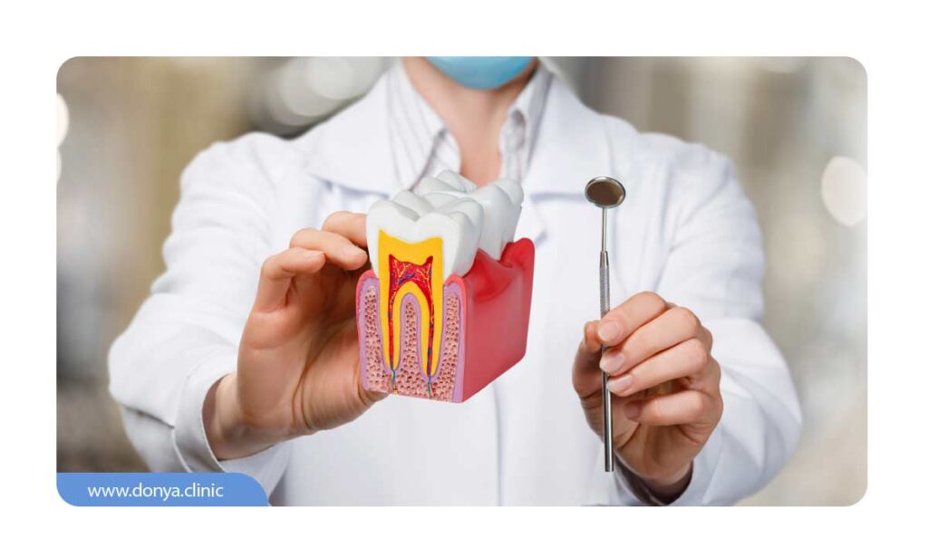 تصویر دندانپزشک که ماکت اعضای داخلی دندان (ریشه دندان) را نمایش می دهد