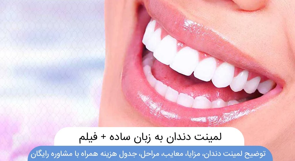 عکس لمینت دندان