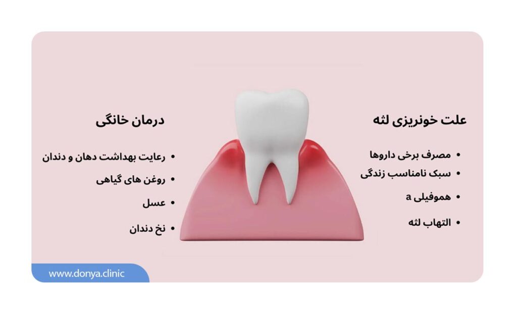 تصویر اینفوگرافیک از علت و درمان خونریزی لثه