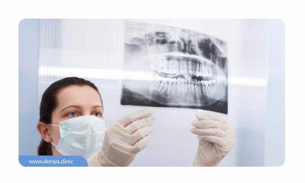 تصویر دندانپزشک در حال بررسی عکس دندان