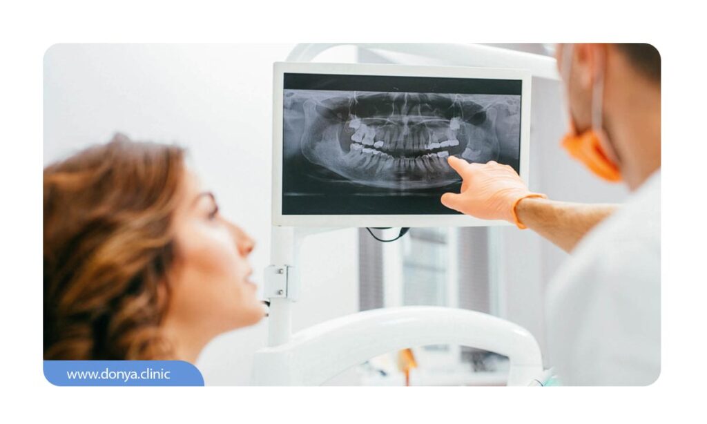 تصویر دندانپزشک در حال توضیح مشکل بیمار از روس عکس دندان opg