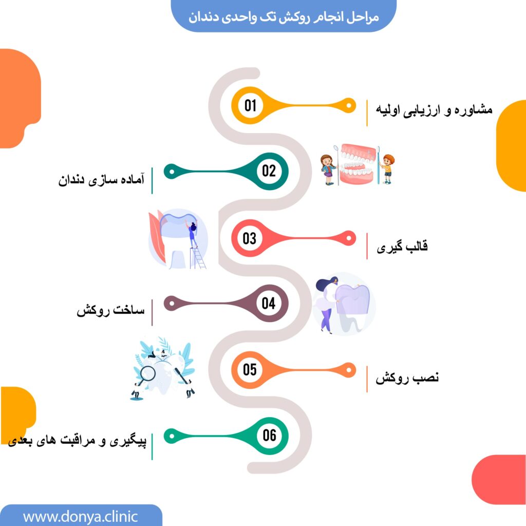 تصویر اینفوگرافیک از مراحل روکش دندان