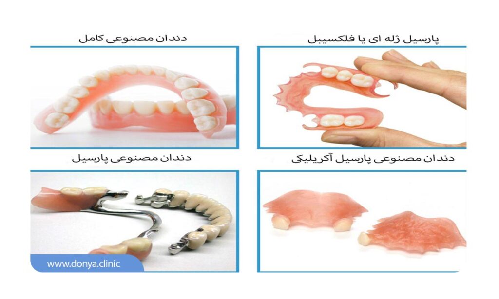 معرفی انواع دندان مصنوعی 