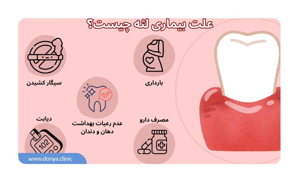 تصویر اینفوگرافیک از بیماری لثه 