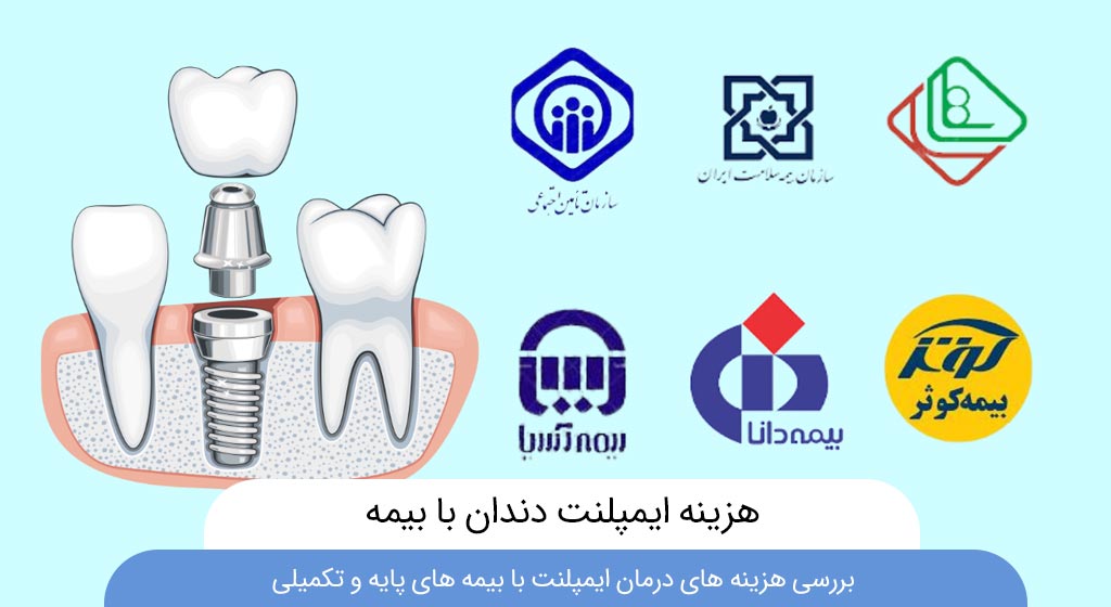 هزینه ایمپلنت دندان با بیمه