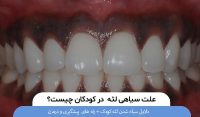 دلایل سیاهی لثه در کودکان