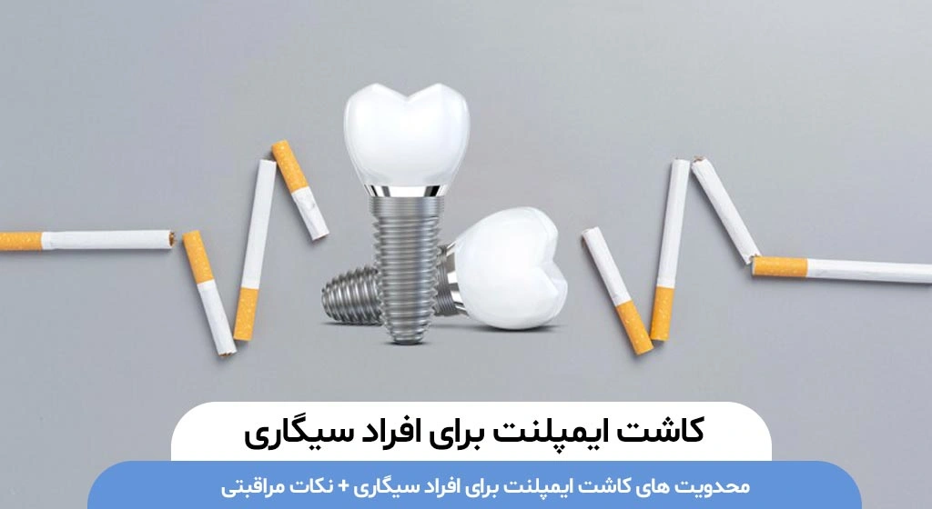 کاشت ایمپلنت برای افراد سیگاری