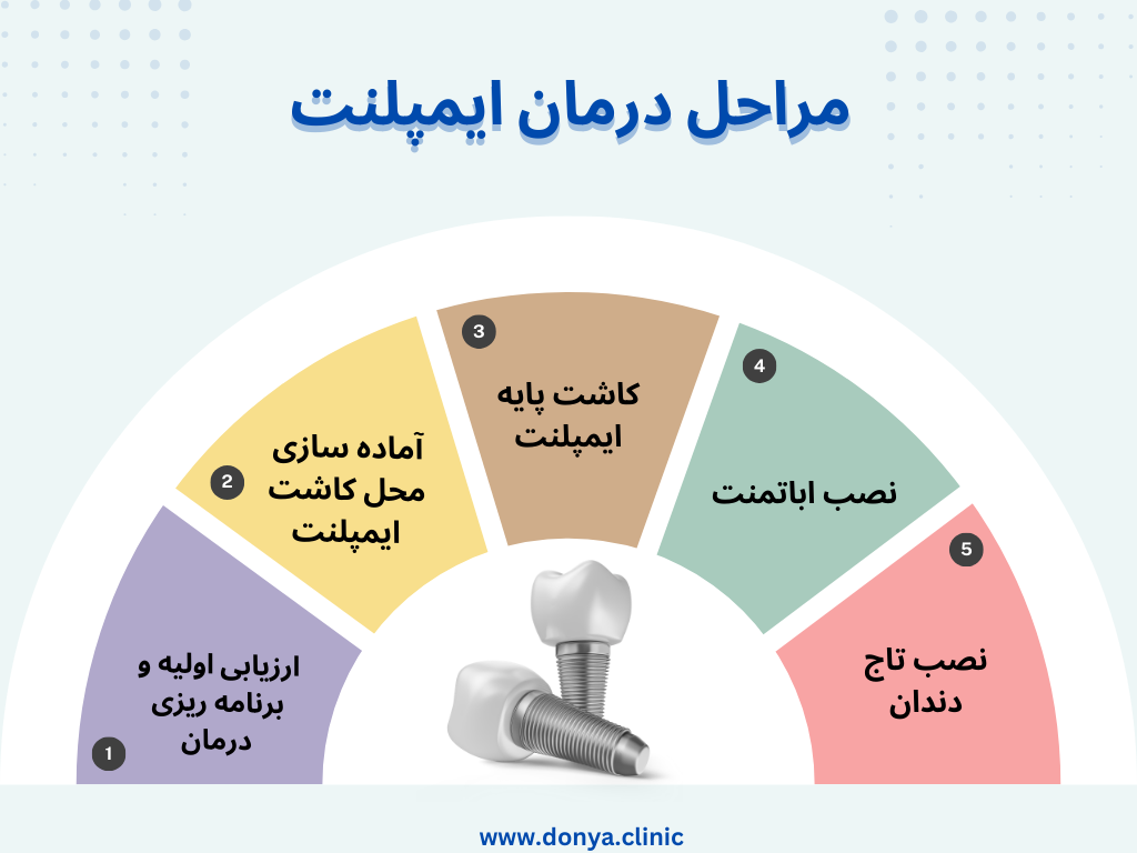 تصویر اینفوگرافی از مراحل ایمپلنت دندان 